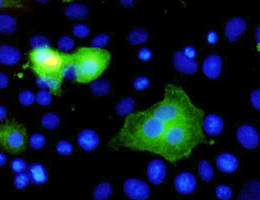 Zellkultur beimpft mit MVA-MERS-S. Das produzierte Impfantigen ist durch Antikörper grün angefärbt dargestellt.